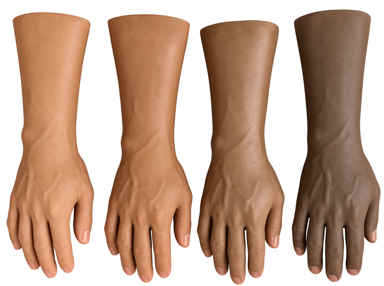 Hand Prosthesis View 1
