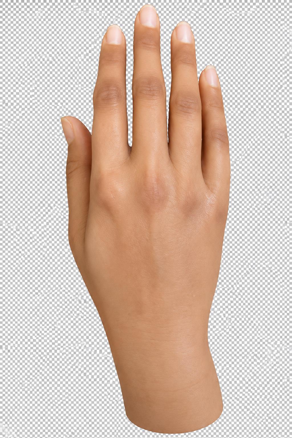 Hand Prosthesis View 2