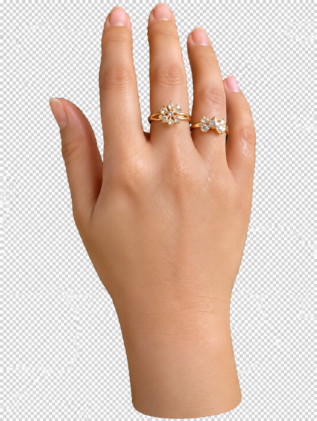 Hand Prosthesis View 3