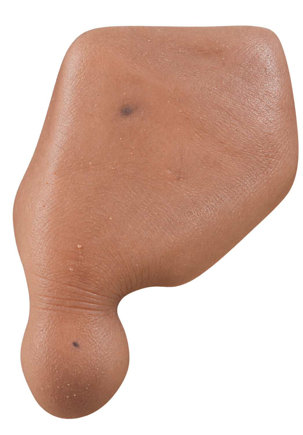 Toe Prosthesis View 3